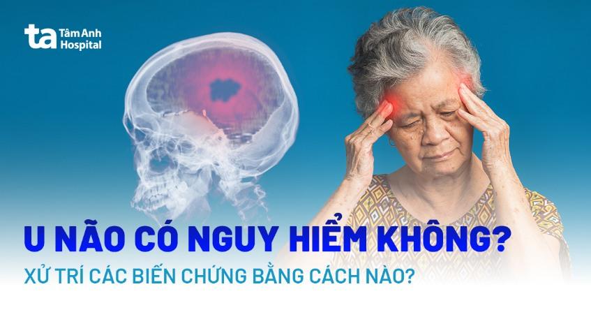 u não có nguy hiểm không