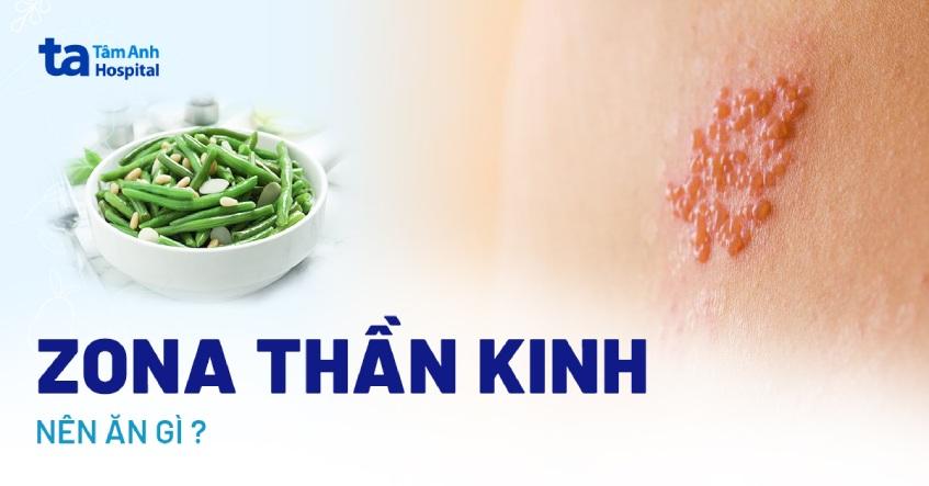 zona thần kinh kiêng gì