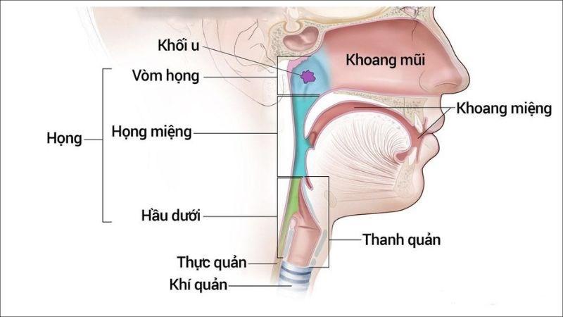 Ung thư vòm họng là sự phát triển không kiểm soát của tế bào vòm họng