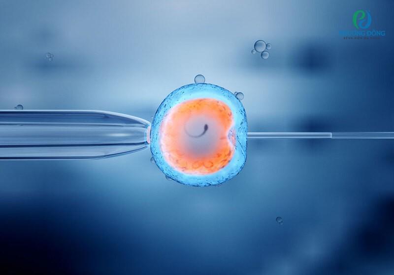 Hướng dẫn mẹ bầu cách tính tuổi thai IVF và ngày dự sinh chính xác