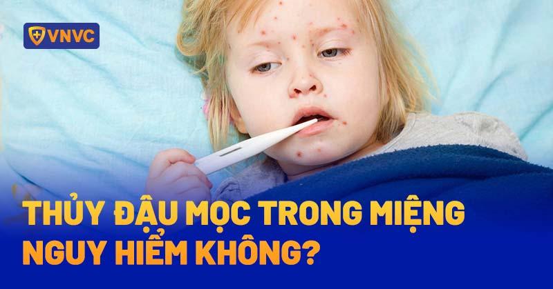 Thủy đậu mọc trong miệng có nguy hiểm không? Cách trị thế nào?