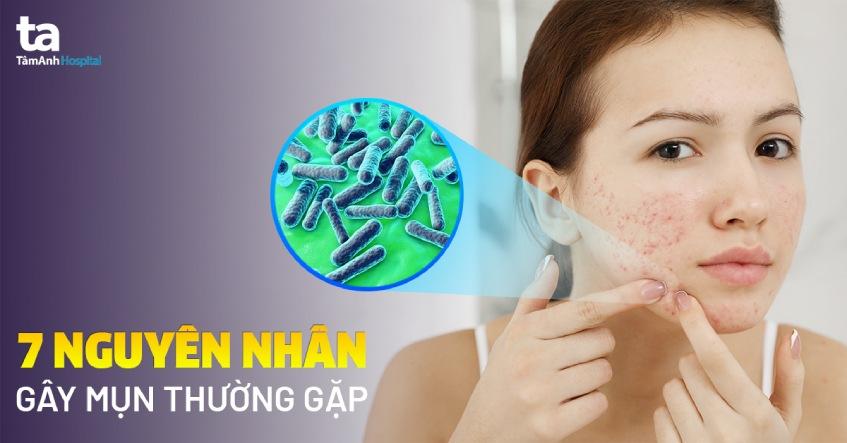 Top 7 nguyên nhân gây mụn phổ biến và những điều cần lưu ý