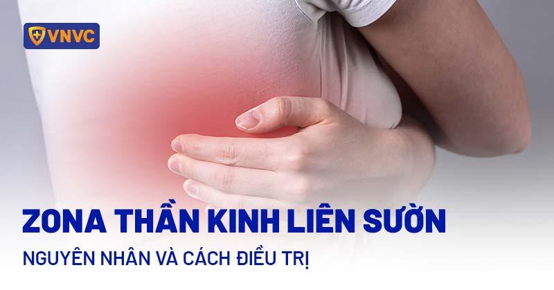 Zona thần kinh liên sườn có lây không? Nguyên nhân và cách điều trị