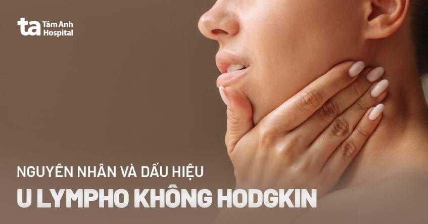 u lympho không hodgkin