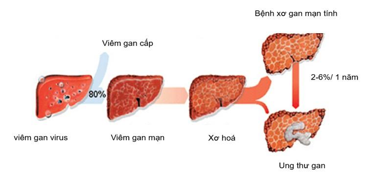 CÁC PHƯƠNG PHÁP CHẨN ĐOÁN UNG THƯ BIỂU MÔ TẾ BÀO GAN