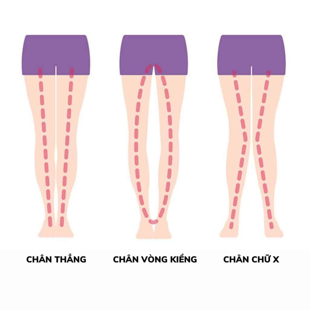 6 bài tập yoga chữa chân vòng kiềng đơn giản cho vóc dáng đẹp