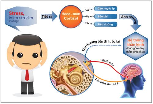 Rối loạn tiền đình có chữa khỏi được không?