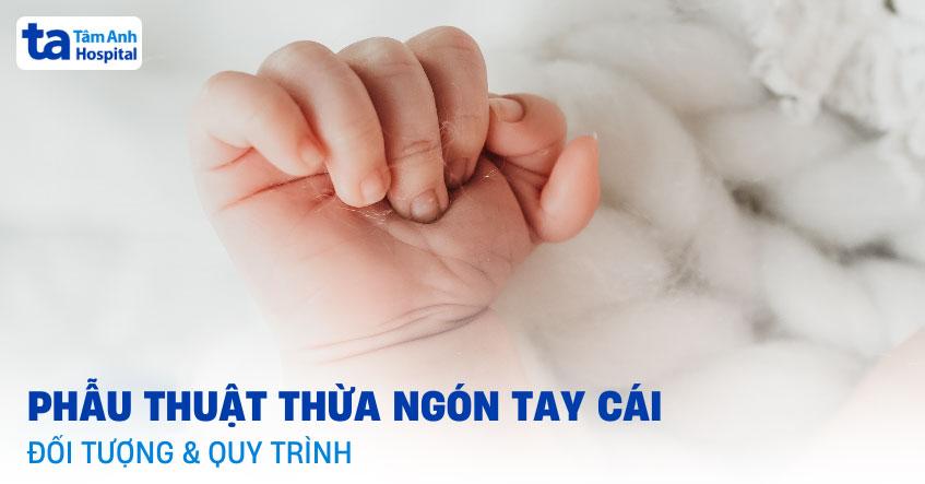 phẫu thuật thừa ngón tay cái