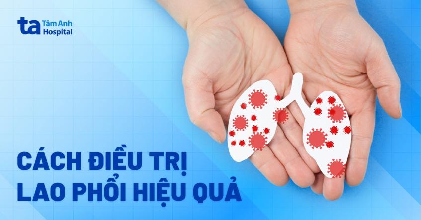 Cách điều trị lao phổi