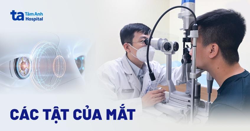 Các tật của mắt phổ biến: Nguyên nhân và cách khắc phục