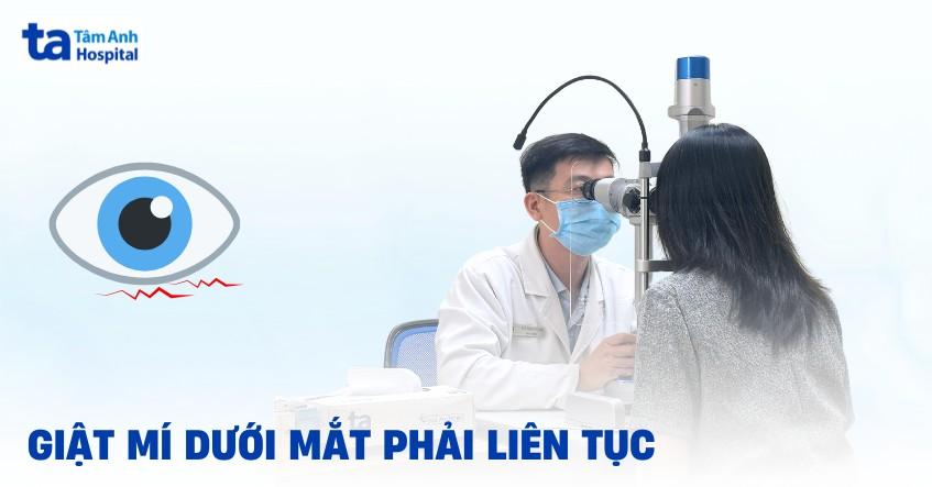 Bị giật mí dưới mắt phải liên tục: Nguyên nhân và cách điều trị