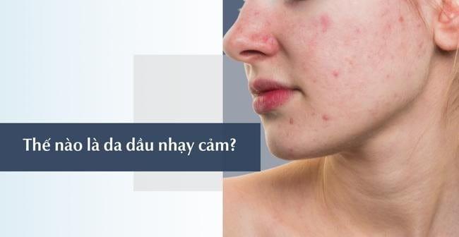 Da dầu nhạy cảm là gì? Cách chăm sóc đúng chuẩn
