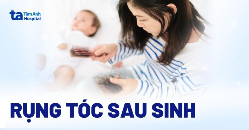 Rụng tóc sau sinh kéo dài bao lâu? Nguyên nhân và cách phòng chống