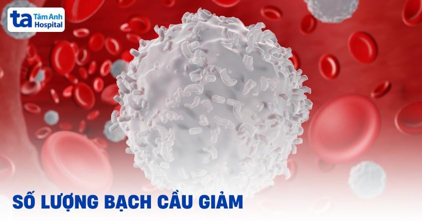 Số lượng bạch cầu giảm: Phân loại, nguyên nhân và triệu chứng