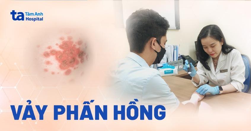 vảy phấn hồng