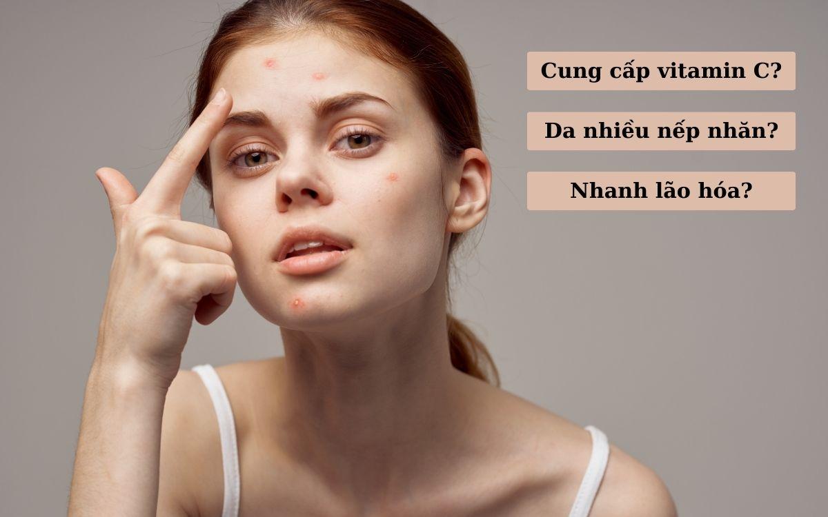 Kẹo Dẻo Collagen Lựu Đỏ Vitamin C Hỗ Trợ Đẹp Da, Tóc, Móng (60 Viên)