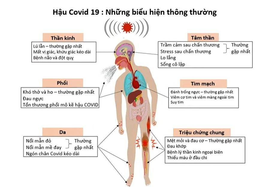 Hậu COVID 2025 (Long COVID): Triệu Chứng & Cách Phục Hồi Toàn Diện