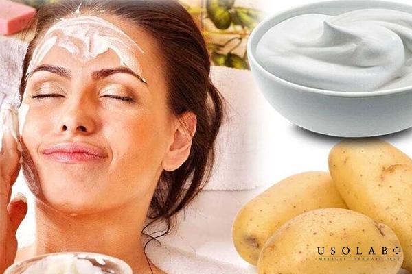 4 Tác hại của mặt nạ khoai tây sữa tươi luôn tiềm ẩn nếu không chú ý